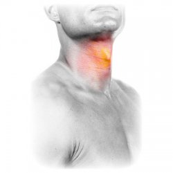 Лечение ангины