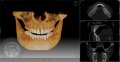 NEW!!! Компьютерная томография челюстно-лицевой области
