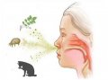 Аллергический насморк: как убрать заложенность носа?