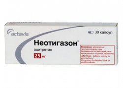 Неотигазон - Отзывы о Неотигазоне
