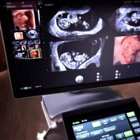 Reprolife (Репролайф) фото