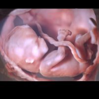 Reprolife (Репролайф) фото