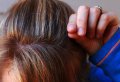 Седые волосы связаны с иммунной системой