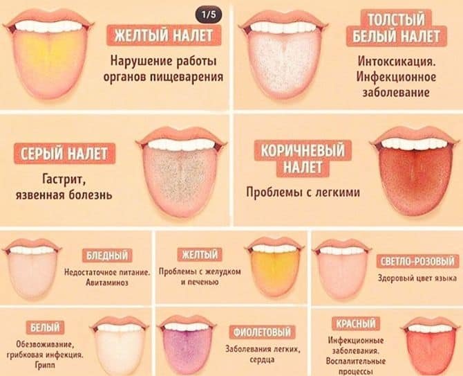Бледный Язык Фото Бледный Язык Фото