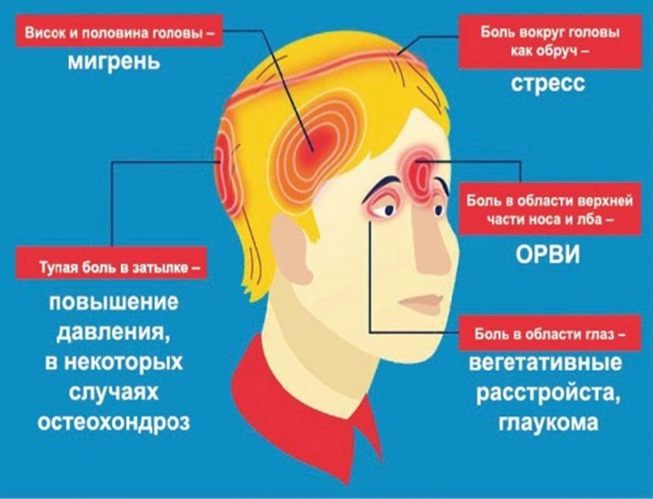 Топ-5 лучших таблеток от головной боли - Medcentre.com.ua