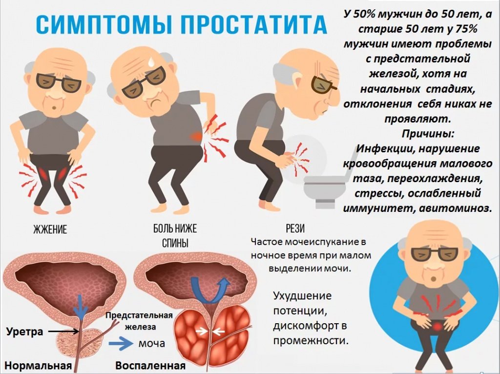 Самые эффективные препараты для лечения простатита - Medcentre.com.ua
