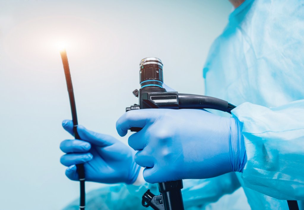 Колоноскопия: что это за обследование и когда его назначают - Medcentre ...