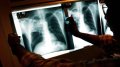 В Украине – эпидемия туберкулеза