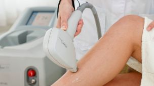 Лазерная эпиляция в Киеве со скидкой 50%
