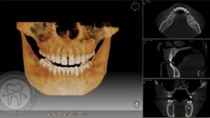 NEW!!! Компьютерная томография челюстно-лицевой области