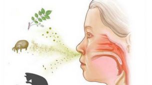 Аллергический насморк: как убрать заложенность носа?