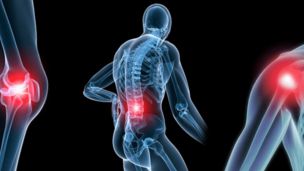 Простые способы избавления от различных болей в суставах