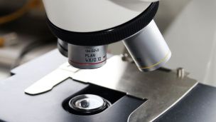 Под микроскопом: вирус гриппа, аллергены, лейкоциты и процесс оплодотворения (ФОТО)