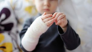 Врач из Гарварда будет учить украинских медиков предупреждать ожоги у детей