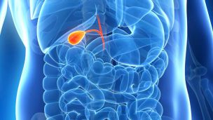 Распространенные проблемы желчного пузыря и как от них избавиться без врача