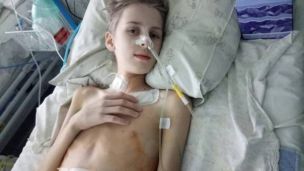 90 % удаленного кишечника и мечта поесть: Денису срочно нужна помощь