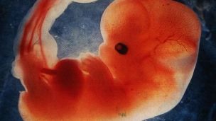 Ученые скрестили человека и обезьяну