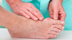 Подагра: что это и как лечить