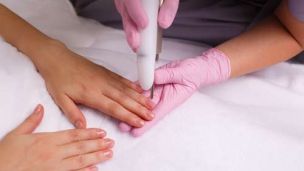 Грибок ногтей предлагают лечить с помощью лазера