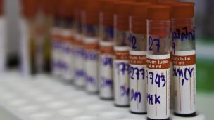 Как снизить уровень холестерина без лекарств