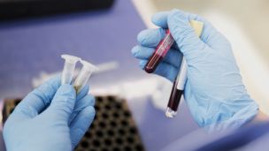 Малоизвестные факты о группах крови