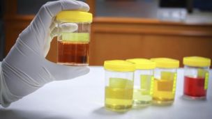 Как по цвету мочи определить заболевание