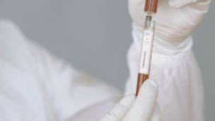 Кличко: что делать, если вам отказали в бесплатном тесте на COVID-19?