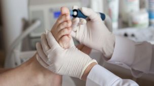 ТОП 5 популярных вопросов подологу