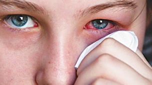 10 симптомов проблем с глазами. Не игнорируйте их!