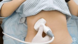 Киста шейки матки