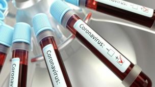 Кому не надо делать прививку от ковида? И дело тут не в антителах!