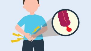 Аппендицит: диагностика и лечение