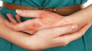 На какие лекарства чаще всего бывает аллергия