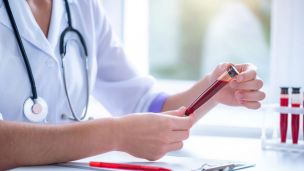 Лучшие препараты для разжижения крови