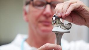 Эндопротезирование – надежный способ восстановления функции коленного сустава