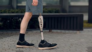 Цивільні дорослі та діти мають право на безкоштовне протезування: як це працює?