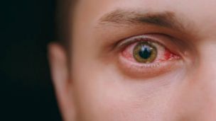 Почувствовала, как ползает паразит: из глаза женщины достали гельминта