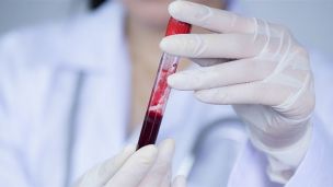 Продукти і препарати для профілактики тромбозу