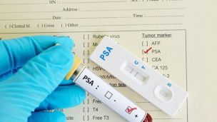 Щоб виявити рак, потрібно буде здати простий аналіз крові