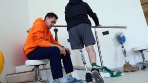 За один місяць в Україні виготовляють 2 тисячі протезів нижніх кінцівок і 200 – верхніх