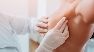 Киста молочной железы: причины, симптомы, лечение