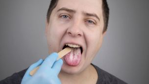 О каких болезнях «расскажет» налет на языке