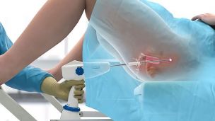 Ерозія шийки матки: чим вона небезпечна?