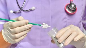 Рак шийки матки: нові правила скринінгу та ранньої діагностики