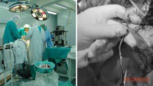 В Днепре спасли военного с гвоздем в мозгу: 5 часов операции и настоящее чудо