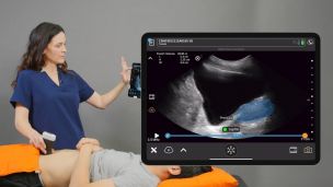 Штучний інтелект навчився «бачити» рак і хвороби серця на звичайному УЗД