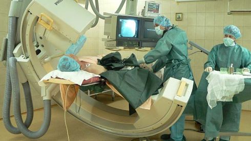 Впервые хирурги удалили орган через пупок