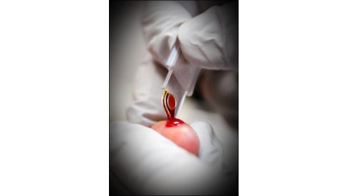 Анализ крови выявит рак печени