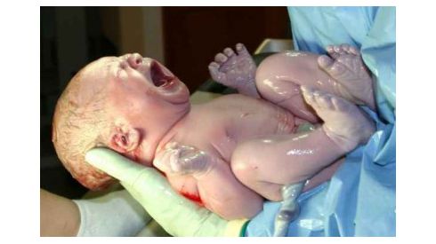 В Мариуполе родился ребенок-великан