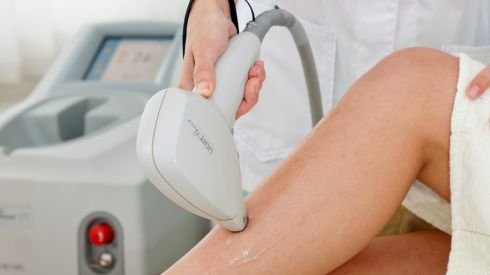Лазерная эпиляция в Киеве со скидкой 50%